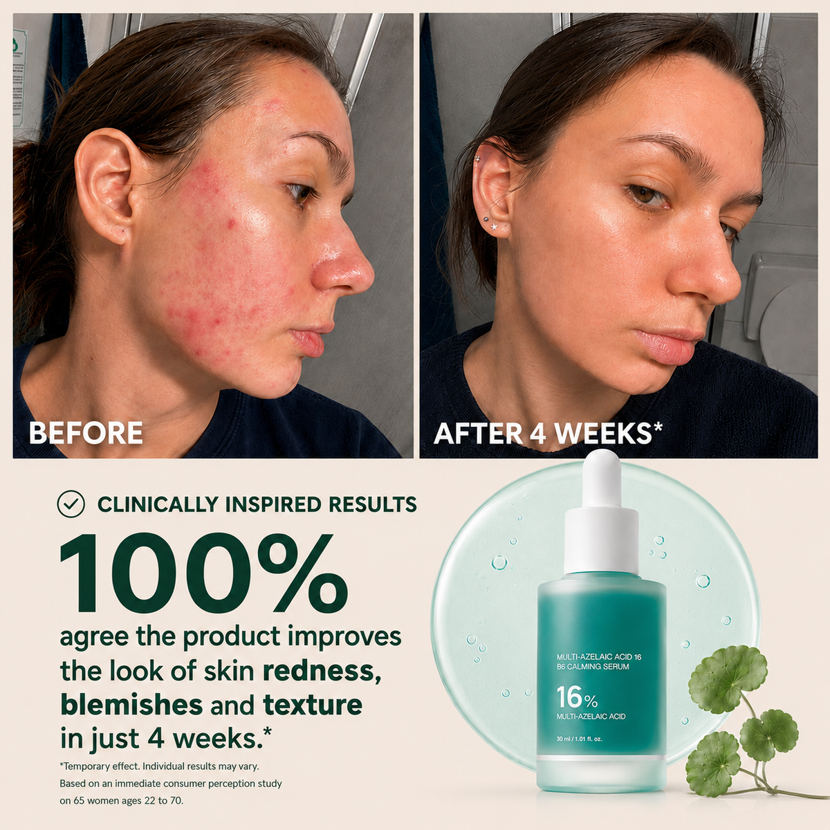 Azelaic Acid Soothing Serum