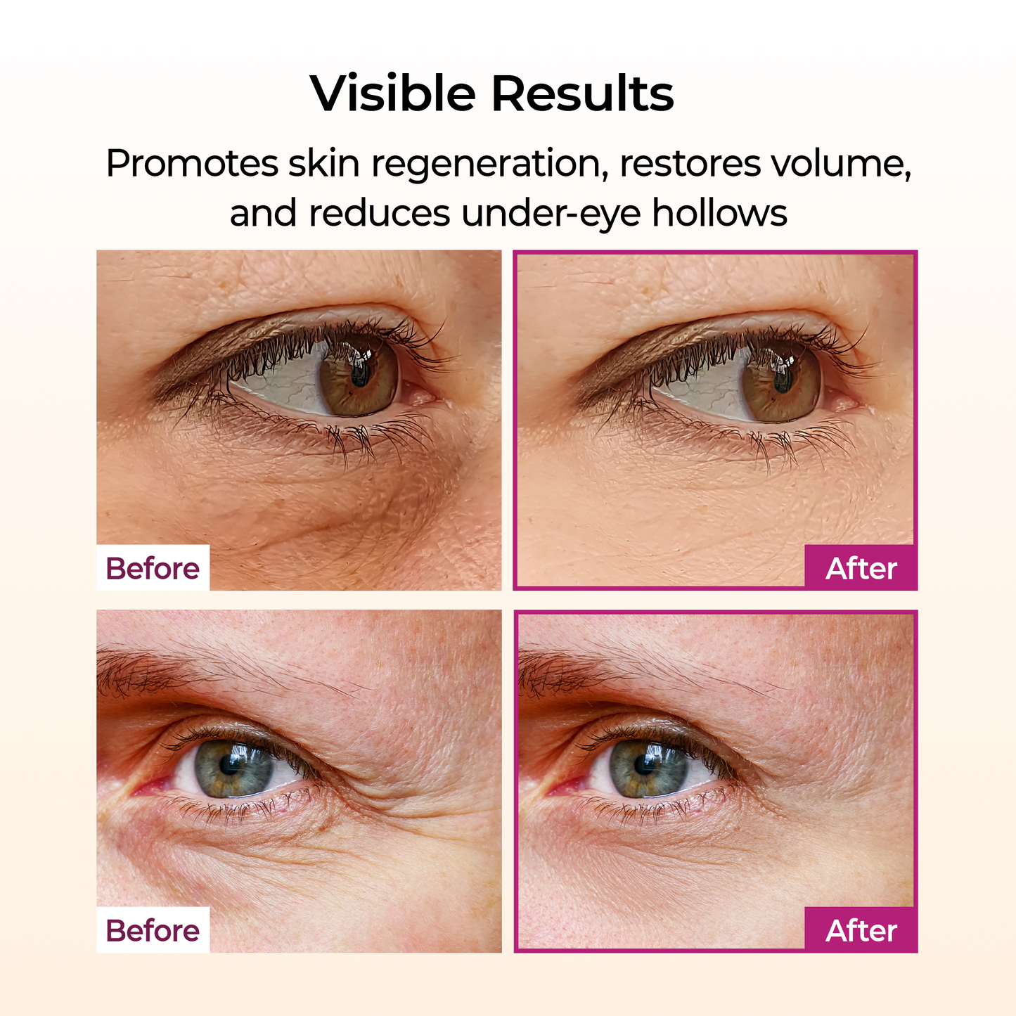 [Dr.Melaxin Official] Calcium Multi Balm Eye Care
