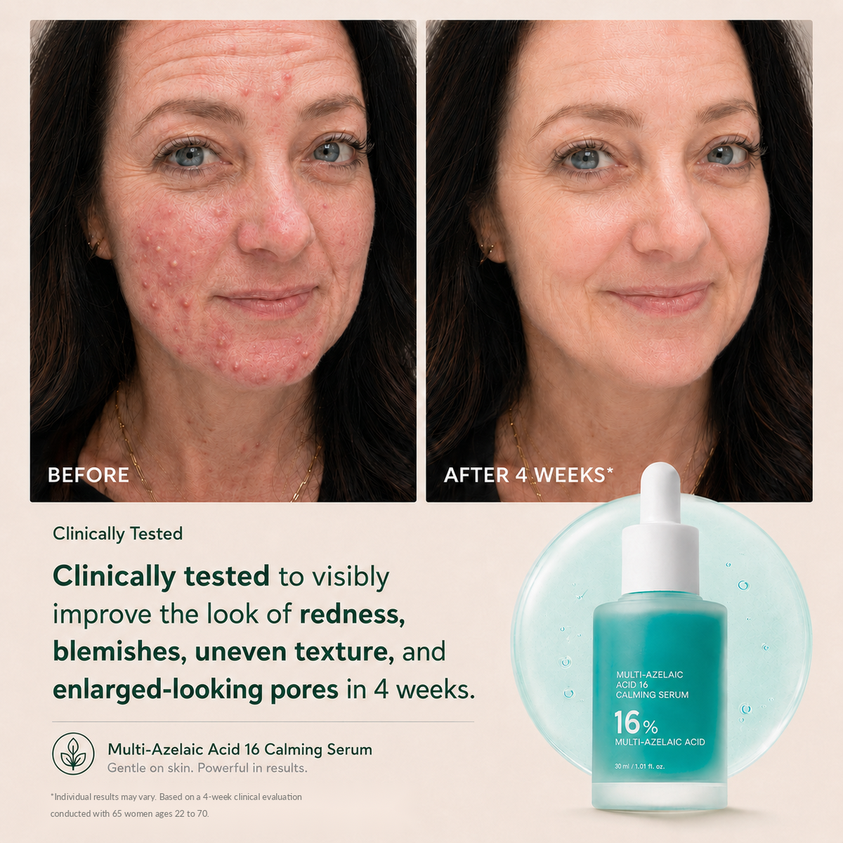 Azelaic Acid Soothing Serum