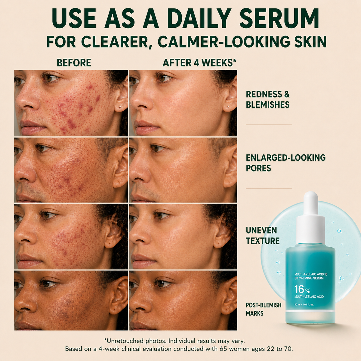 Azelaic Acid Soothing Serum