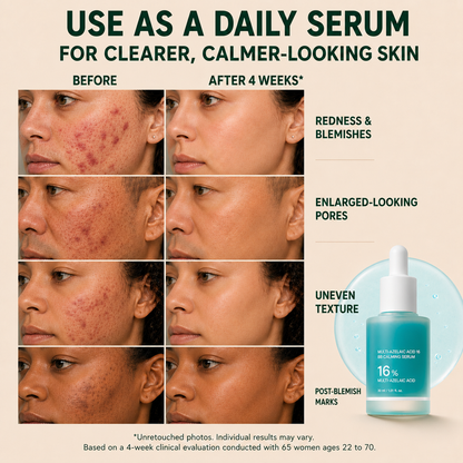 Azelaic Acid Soothing Serum