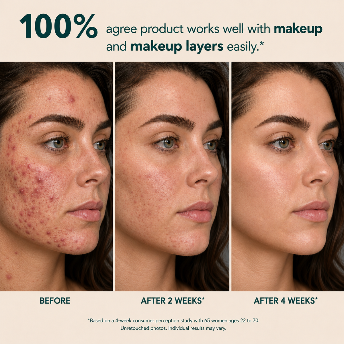 Azelaic Acid Soothing Serum